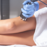 Could This New Treatment Change the Way We Approach Cellulite?