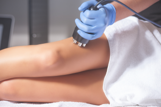 Could This New Treatment Change the Way We Approach Cellulite?