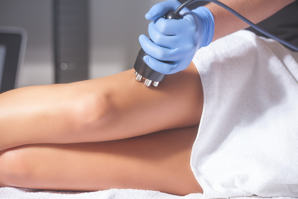 Could This New Treatment Change the Way We Approach Cellulite?